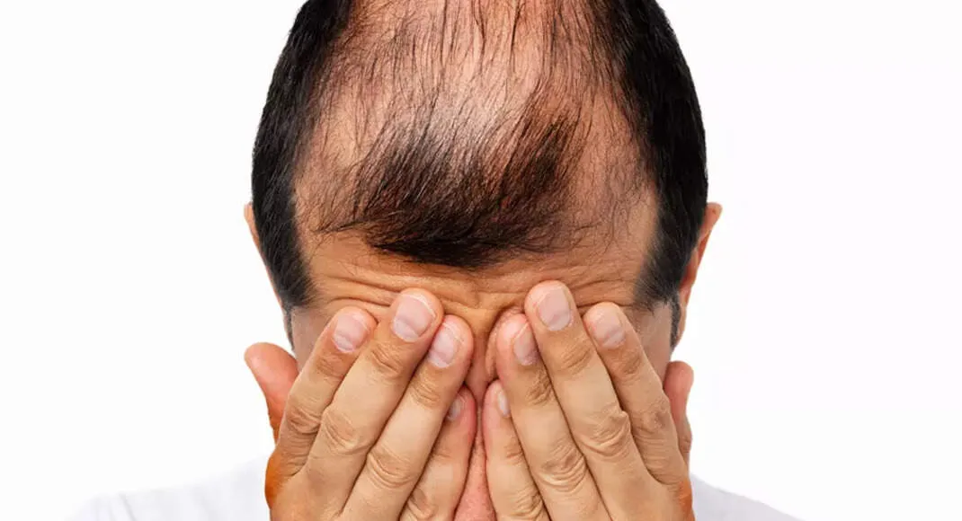 Sun Pharma FDA nod for Leqselvi as alopecia drug fight heats up against Pfizer and Eli Lilly