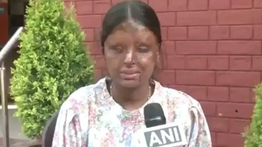 Acid Attack Survivor Kafi Tops 12 Boards With 95 Plus Scores Against All Odds