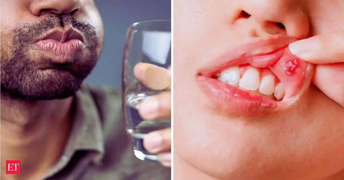 Listerine Cool Mint could raise cancer risk, study warns about oral bacteria