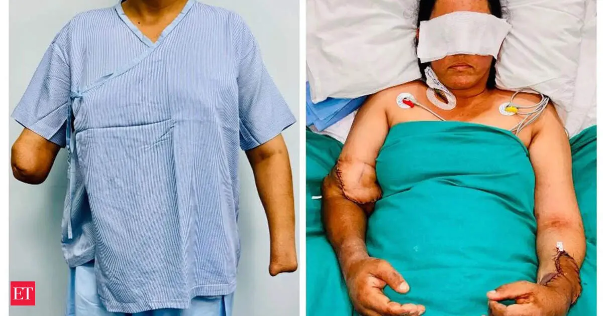 Young mother regains hands after 12 hour bilateral transplant brings fresh hope