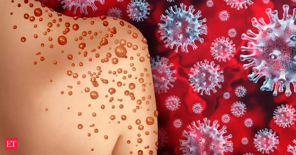 Mpox Clade Ib spreads fast as scientists struggle to track mutations and transmission